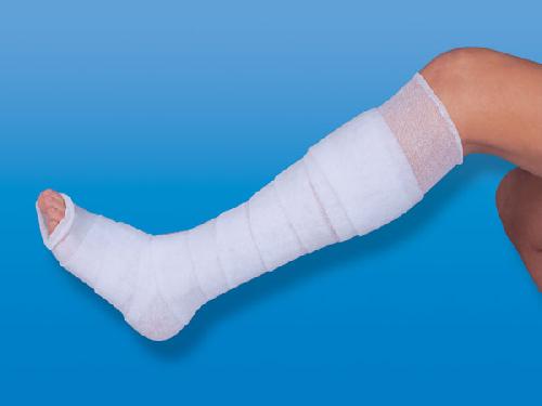 NOBATRICOT, bílý elastický trubkový obvaz, délka 20 m, šířka 10,0 cm