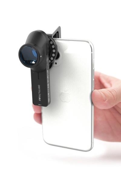 DERMLITE DL1 Basic, dermatoskop s adaptérem pro mobil
