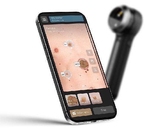 DERMLITE DL5 PLUS, profesionální dermatoskop s variabilní polarizací