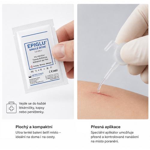 EPIGLU, tkáňové lepidlo, jedna dávka s 0,3 g