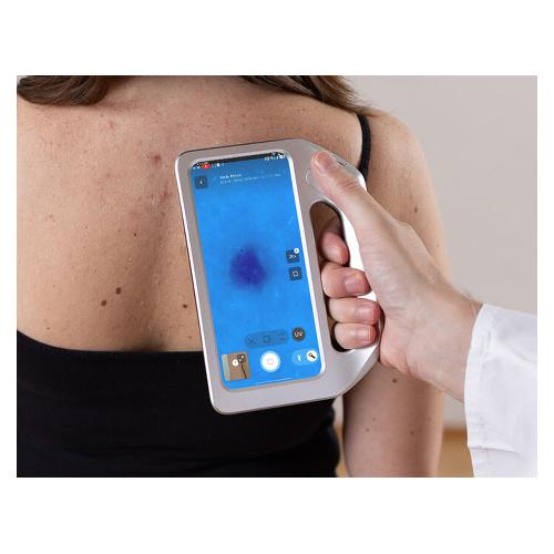 DERMLITE SKEEN - kompletní dermatoskopický systém