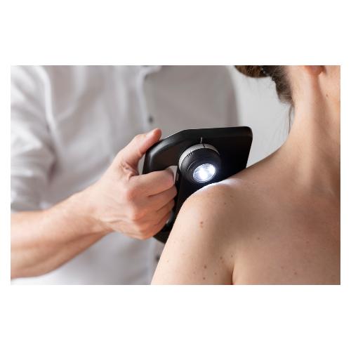 DERMLITE SKEEN - kompletní dermatoskopický systém